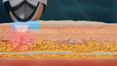 key point gif